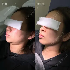 HAAB×DREAM BEAUTY CLINIC 東京本院 吉岡 修一医師の症例