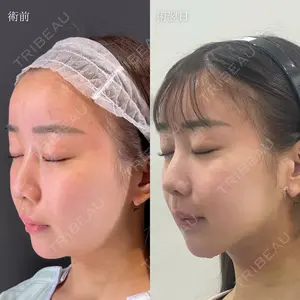 HAAB×DREAM BEAUTY CLINIC 東京本院 吉岡 修一医師の症例