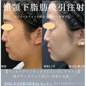 湘南美容クリニック 豊橋院 柳 立樹医師の症例