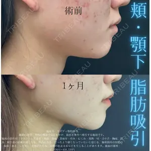 湘南美容クリニック 名古屋駅本院 友池 力医師の症例