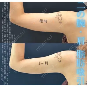 湘南美容クリニック 名古屋駅本院 友池 力医師の症例