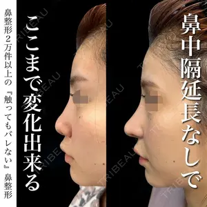 グローバルビューティークリニック 銀座院 理事長　杉崎　裕斗医師の症例