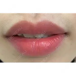 しんゆり美容健康クリニックの症例