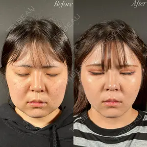 R Beauty CLINIC 名古屋院 木村 尚大医師の症例