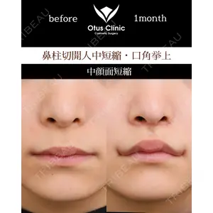 Otus Clinic 【オータスクリニック】 中 徳太郎医師の症例