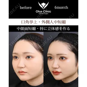 Otus Clinic 【オータスクリニック】 中 徳太郎医師の症例