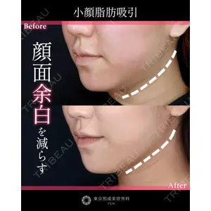 東京形成美容外科 船橋院 弓削田　浩主医師の症例