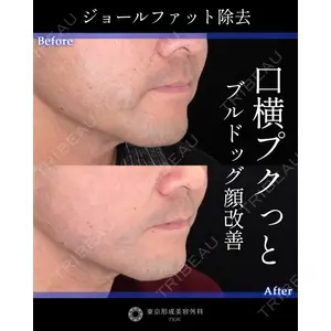 東京形成美容外科 船橋院 山崎 修吾医師の症例
