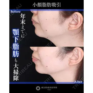 東京形成美容外科 船橋院 山崎 修吾医師の症例