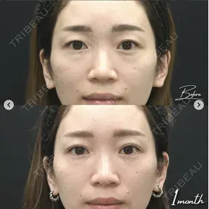 湘南美容クリニック 銀座院の症例