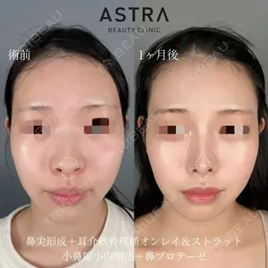 ASTRA BEAUTY CLINIC 塩満 惠子医師の症例