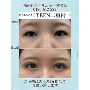 湘南美容クリニック 博多院 渥美 智晶医師の症例