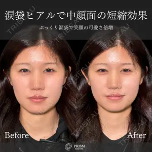 PRISM Beauty Clinic 新宿院 畑山 知輝医師の症例
