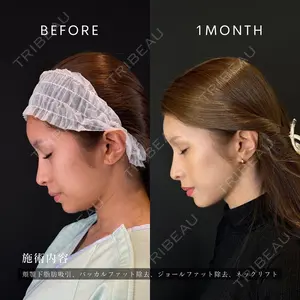 HAAB BEAUTY CLINIC 南青山本院（新院） 金子 雄医師の症例