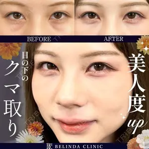 BELINDA CLINIC（ベリンダクリニック）新宿院 井上 真梨子医師の症例