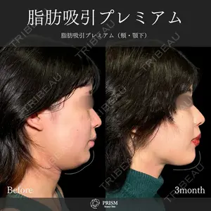 PRISM Beauty Clinic 畑山 知輝医師の症例
