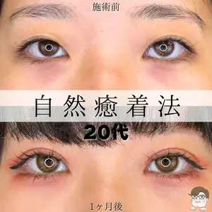 ルラ美容クリニック 札幌院 佐藤 雄紀医師の症例