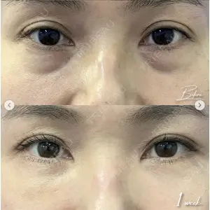 湘南美容クリニック 銀座院の症例
