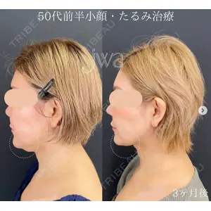 自由が丘ウェルエイジングビューティークリニック 福田 知佐子医師の症例