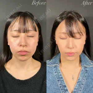 R Beauty CLINIC 名古屋院 木村 尚大医師の症例