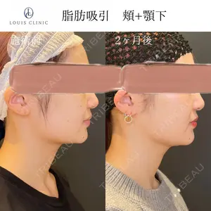 LOUIS CLINIC 二子玉川院【ルイクリニック】 小松 塁医師の症例