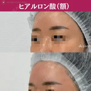 ギャラリークリニック 銀座の症例