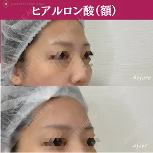 ギャラリークリニック 銀座の症例