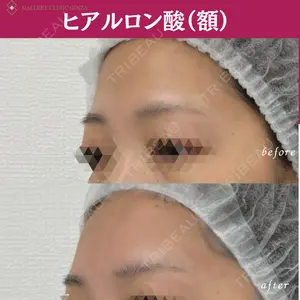 ギャラリークリニック 銀座の症例