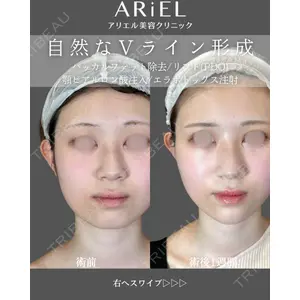 アリエル美容クリニック 郡山院の症例