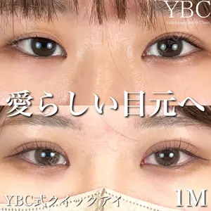 YBC横浜美容外科 大宮院 磯村 亮輔医師の症例