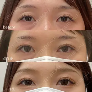 REDLINE CLINICの症例