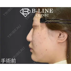 B-LINE CLINIC 池袋院 小池 康弘医師の症例