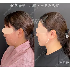 自由が丘ウェルエイジングビューティークリニック 福田 知佐子医師の症例