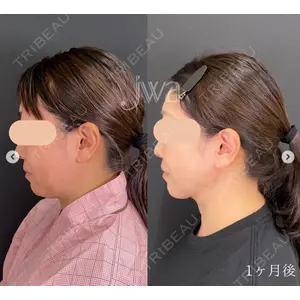 自由が丘ウェルエイジングビューティークリニック 福田 知佐子医師の症例