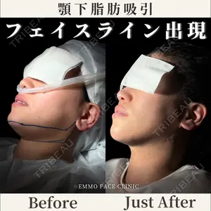 EMMO FACE CLINIC 東京三田院 木之下 哲彦医師の症例
