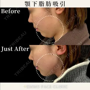 EMMO FACE CLINIC 東京三田院 木之下 哲彦医師の症例