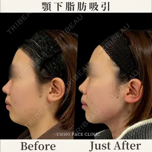 EMMO FACE CLINIC 東京三田院 木之下 哲彦医師の症例