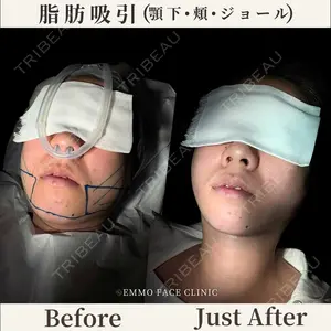 EMMO FACE CLINIC 東京三田院 木之下 哲彦医師の症例