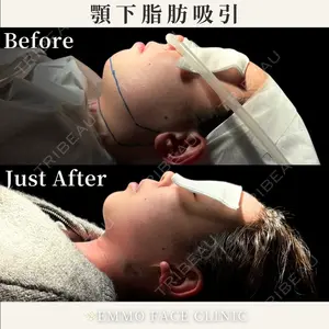 EMMO FACE CLINIC 東京三田院 木之下 哲彦医師の症例