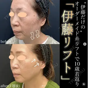 湘南美容クリニック 名古屋駅本院 伊藤 整医師の症例