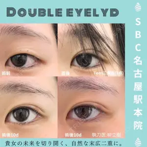 湘南美容クリニック 豊橋院 柳 立樹医師の症例