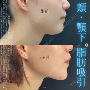 湘南美容クリニック 名古屋駅本院 友池 力医師の症例