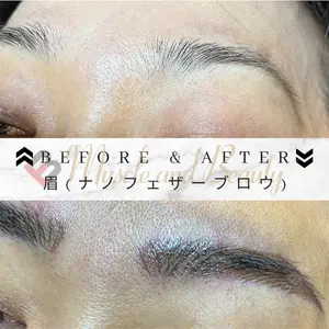 筋肉・美容クリニック 田中 詩織（しおり先生）医師の症例