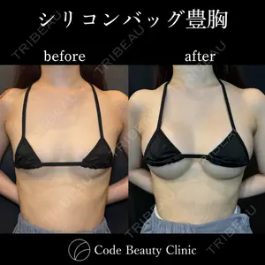 Code Beauty Clinic 名古屋院 橋本 祥平医師の症例