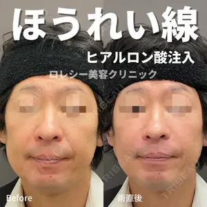 ロレシー美容クリニック 心斎橋駅前院 田中先生医師の症例
