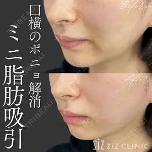 ziz CLINIC 村岡 史子医師の症例