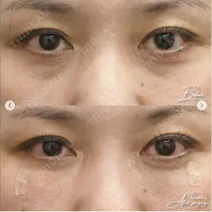 湘南美容クリニック 銀座院の症例