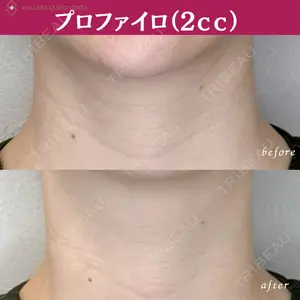 ギャラリークリニック 銀座 西川医師の症例