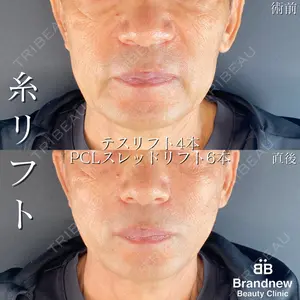 Brandnew Beauty Clinicの症例