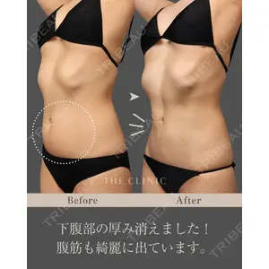 THE CLINIC（ザ・クリニック） 東京院 加藤 敏次医師の症例